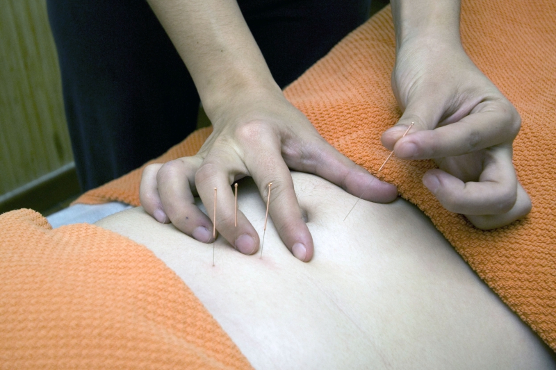 osteopathe-BAIROLS-min_acupuncture-4175625